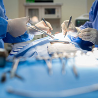 Nguyên nhân 7: Phẫu thuật cắt bỏ tử cung 1