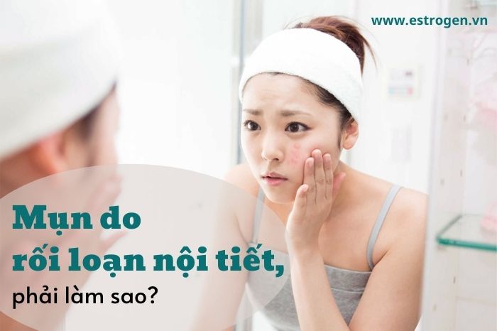 Mụn do rối loạn nội tiết tố nữ, phải làm sao?