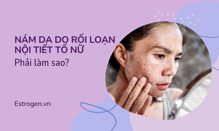 Nám da do rối loạn nội tiết tố nữ: Phải làm sao? 1 Nám da do rối loạn nội tiết tố nữ: Phải làm sao? 1