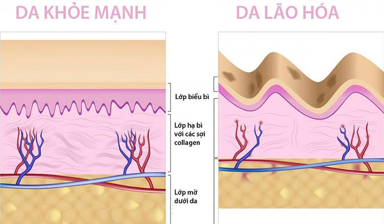 Vì sao trẻ hóa da mặt 