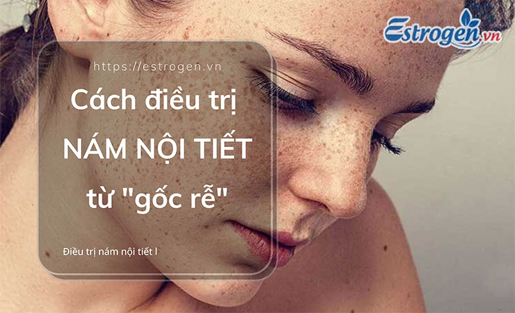 Cách ĐIỀU TRỊ NÁM NỘI TIẾT từ 