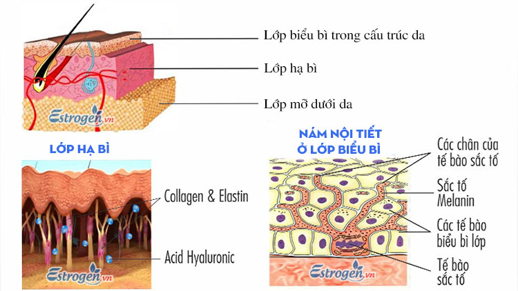 Nám nội tiết là gì? 1