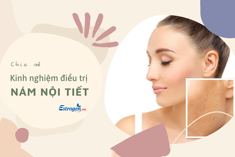 Chia sẻ kinh nghiệm trị nám nội tiết- chữa dứt điểm hiệu quả 1