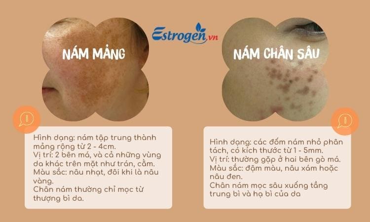 Phân biệt nám mảng và nám chân sâu 1